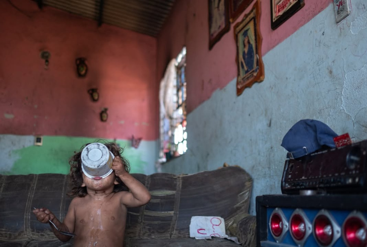 Children face hunger in Venezuela crisis